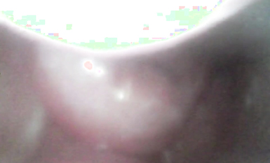 極品媚態蜜汁白虎嫩鮑美少女▌Yua▌肛塞異物陰蒂高潮 頂宮顫攣 窺視揭秘陰道內部高潮G點 (6)